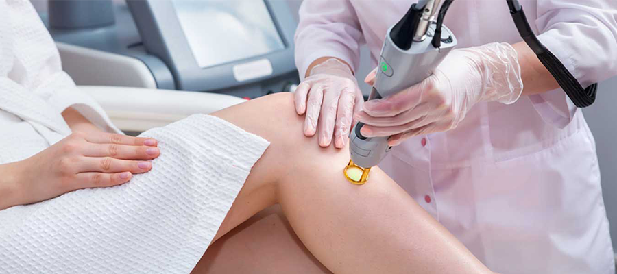 Ironing System Laser Epilation