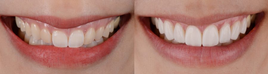 Smiling Disorder