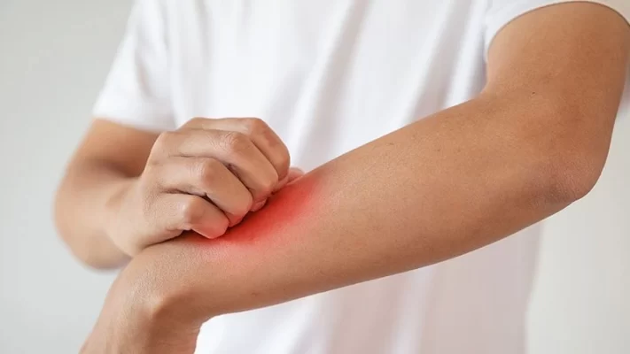 Mantar Enfeksiyonları